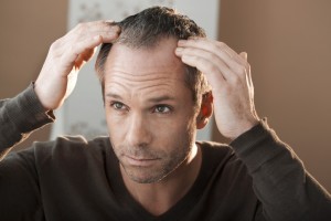 Hair Loss Cases in New Jersey