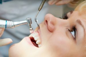 Woman Undergoing Dental Cleaning