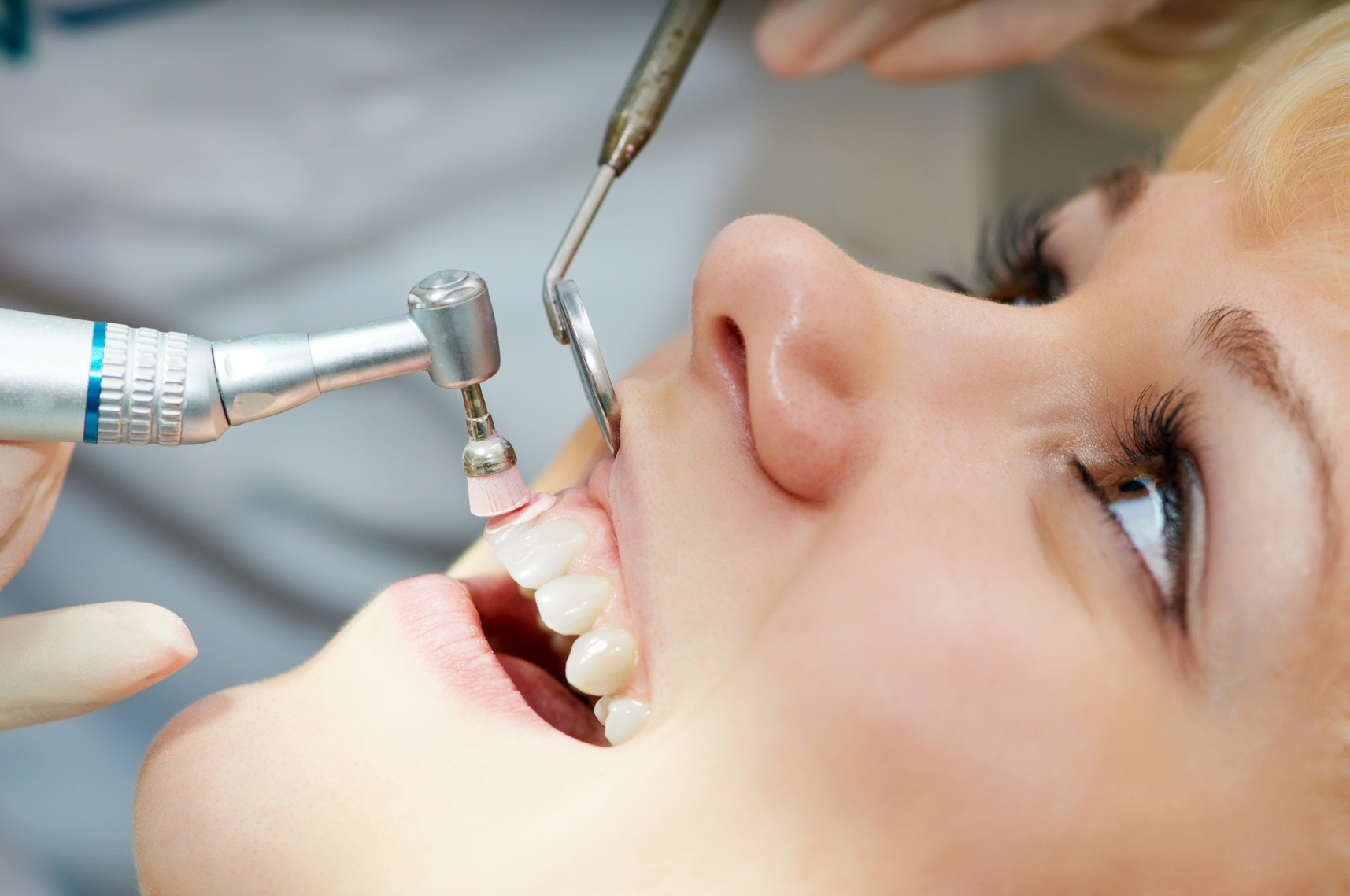 The Wonders of Professional Teeth Cleaning