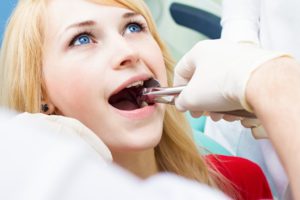 Dentist performing tooth extraction