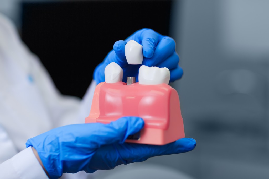 Pediatric Dental Crowns: Options You Could Consider