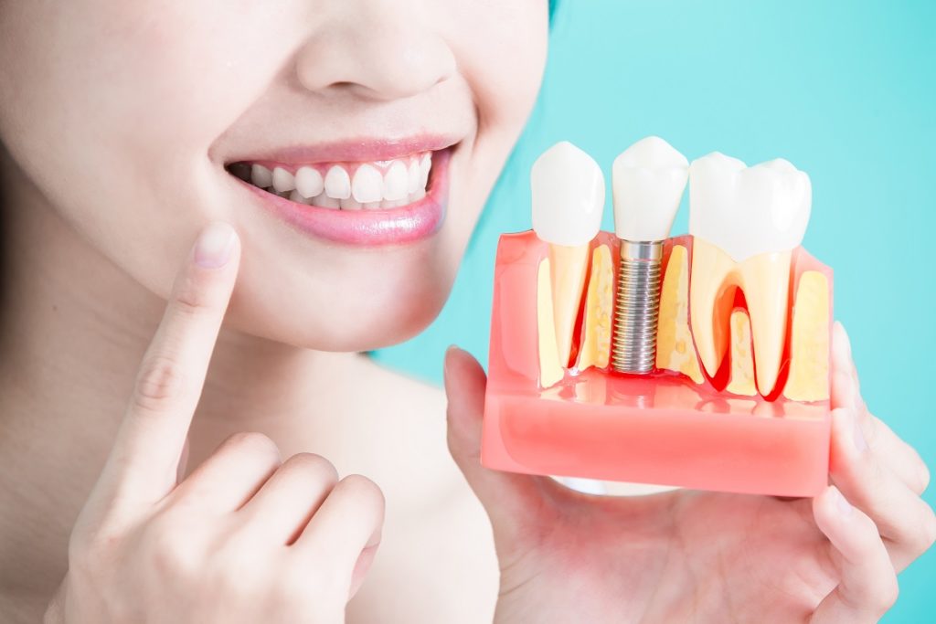 Patient holding a dental implant model