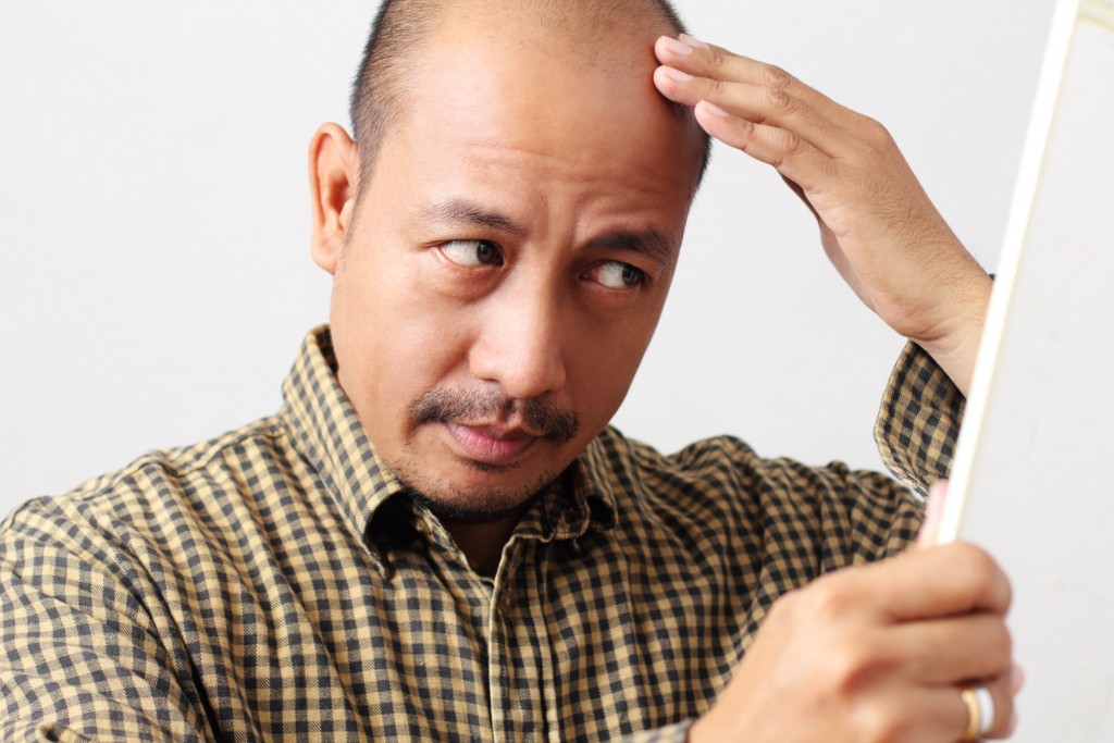 Scalp Pigmentation vs. Hair Transplants: Which One Is Better?